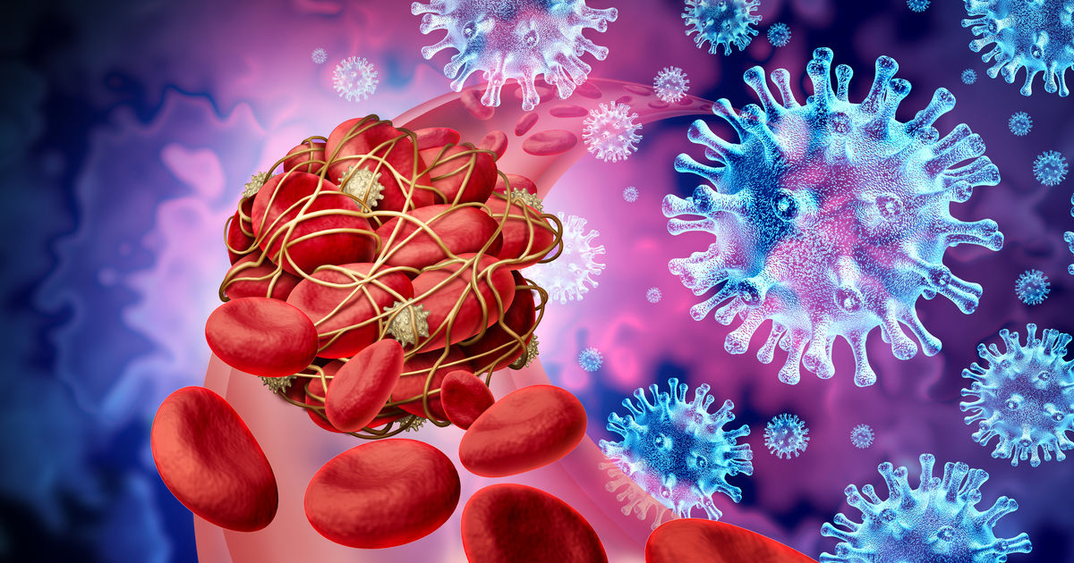 Long COVID in 2025: Biomarkers, Microclots, and the Shift Toward Mechanism-Based Classification